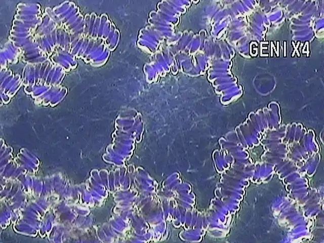 Agregação de fibrinas em microscopia de sangue vivo