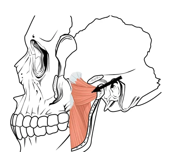 Ilustração anatômica dos músculos da mastigação em vista lateral: temporal, masseter e pterigóideos, destacando o pterigóideo lateral profundo atrás da maxila e abaixo da órbita